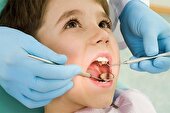 آغاز پویش ملی سلامت دهان و دندان از ۱۷ اردیبهشت ماه در البرز