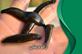 زالو درمانی (مزایا و معایب)
